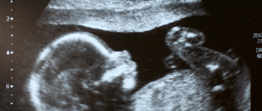 Event-Image for 'Eingriff vor der Geburt - Ein Griff in die Schöpfungskammer'