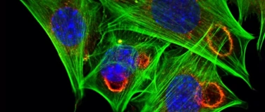 Event-Image for 'LIFEum3: Querverbindungen im Stammbaum des Lebens'