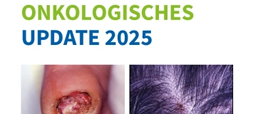 Event-Image for 'Dermatoonkologisches Update'