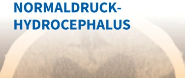 Event-Image for 'Hydrocephalus, inkl. der Besonderheiten bei NPH'